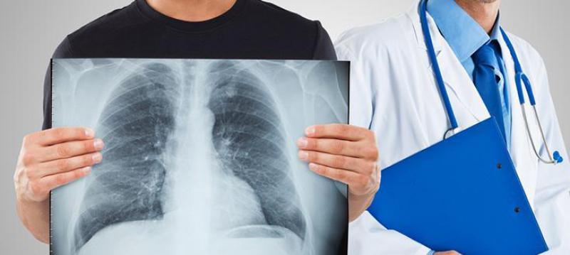 Akciğerde Yara Belirtileri ve Tedavisi