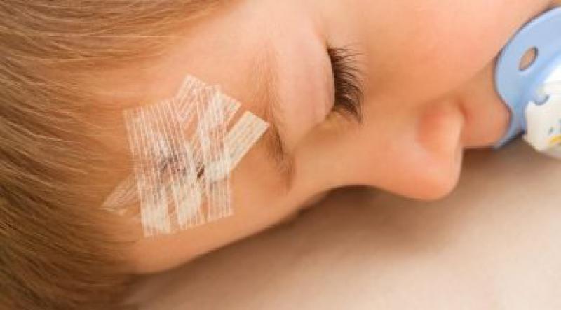 Kafa Yarılması Belirtileri ve Tedavisi