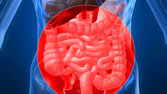 Kalın Bağırsakta Yara Belirtileri ve Tedavisi