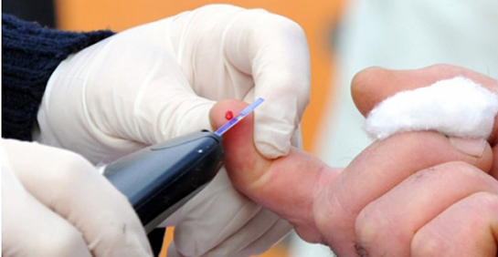 Şeker Yaraları Belirtileri ve Tedavisi