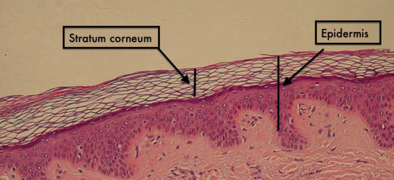 Yara Kabuğu Özellikleri ve Faydaları Nelerdir?